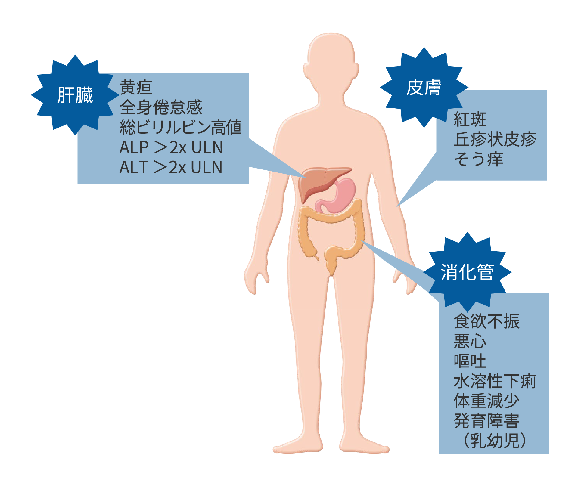 急性GVHDの症状