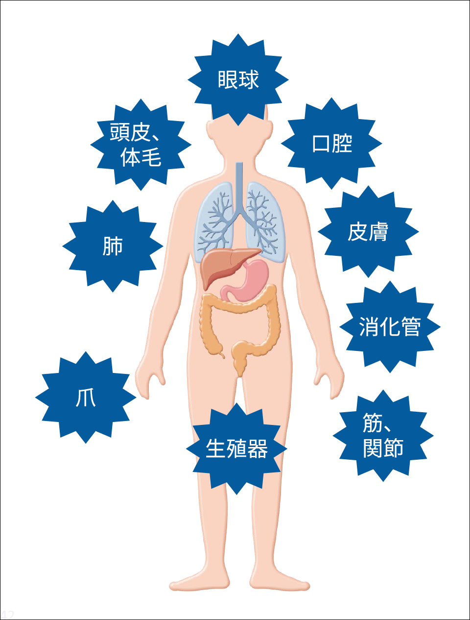 慢性GVHDの症状